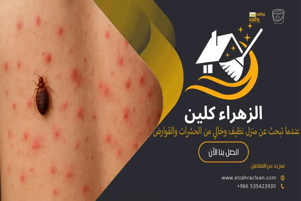 مكافحة بق الفراش مكافحة البق بق الفراش حشرة البق حشرات الفراش بق فراشي بقه الفراش حشرة الفراش قرصة البق أفضل المبيدات للقضاء على بق الفراش أفضل شركة مكافحة بق الفراش بالاحساء شركة مكافحة بق الفراش بالاحساء شركات رش البق بالاحساء أفضل شركة لرش البق أحسن شركة لإبادة البق نصائح وإرشادات للتخلص من بق الفراش نهائيًا طرق مكافحة بق الفراش أهمية مكافحة بق الفراش التخلص من بق الفراش بالاحساء الكلمات الأقل تأثيرًا ولكن مهمة للسيو الداعم: أسعار شركات رش البق بالاحساء كيفية التعرف على وجود بق الفراش في المنزل كيفية التعامل مع بيض البق كيفية مكافحة البق بالطرق الطبيعية التخلص من البق باستخدام البخور أسباب ظهور حشرات بق الفراش وكيفية الوقاية منها ما هو بق الفراش شركة الزهراء كلين